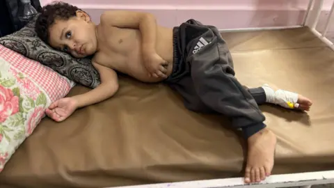 Children in Gaza Suffer Amidst Medical Crisis