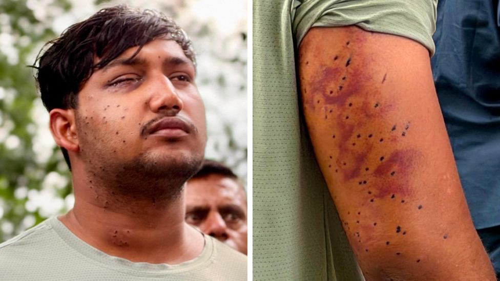 Pellet Guns, Protest and Indigenous Wisdom: Delhi’s Cry for Compassion