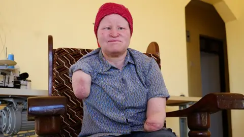 Election Season Brings Terror to People with Albinism in Tanzania