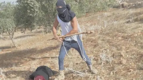 Olive Harvest Assault: Palestinian Woman Hospitalized After Settler Attack