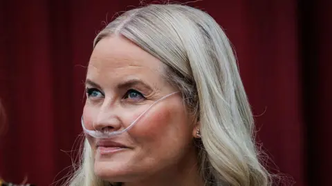 Norway’s Crown Princess’s Lung Transplant Sparks a Conversation on Indigenous Respiratory Health
